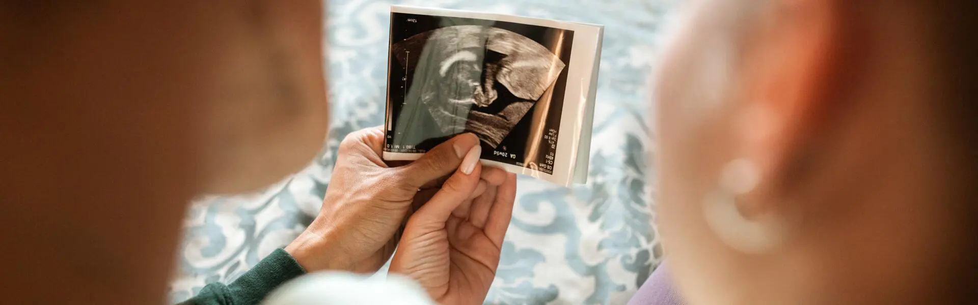 Par tittar på bild från ultraljud. Par tittar på bild från ultraljud.