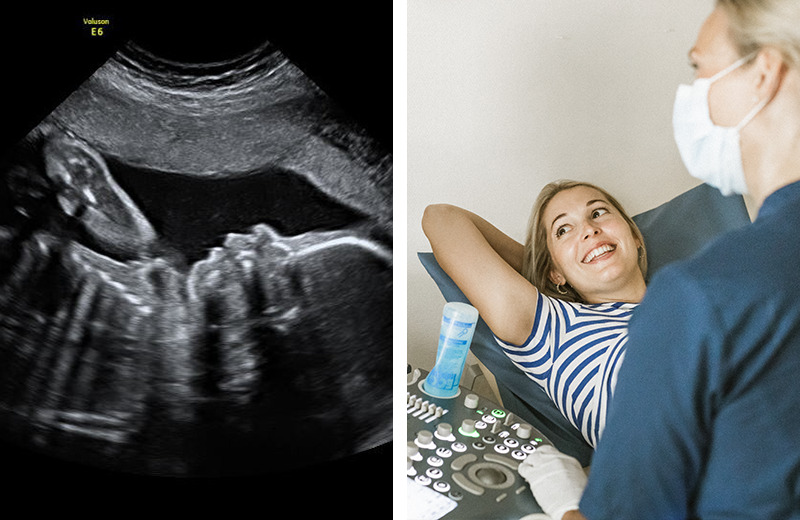 Ultraljudsbesök Ultraljudsbesök