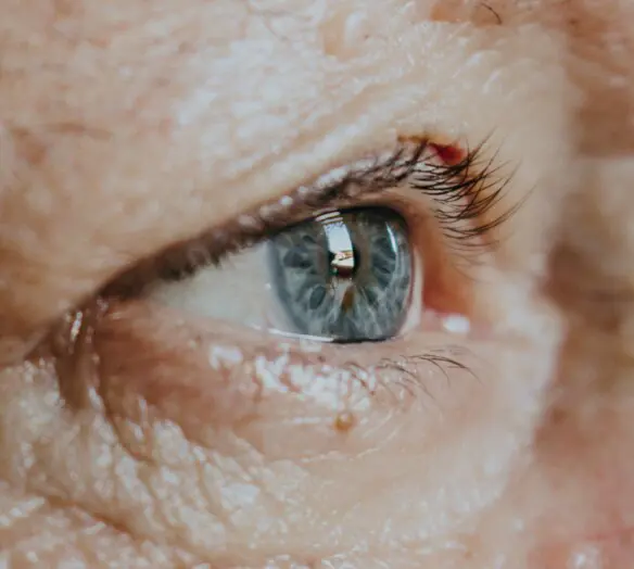 Ögonundersökning Capio Ögon