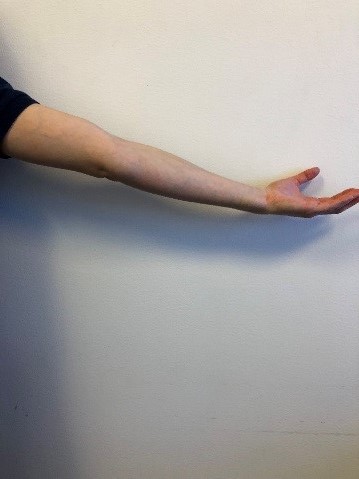 Armen utstr&auml;ckt rakt fr&aring;n kroppen, i sidled.  